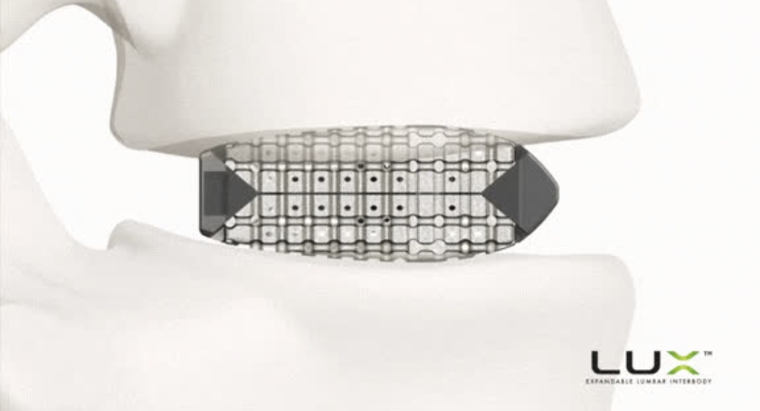 FDA OKs Xenix Medical’s Lux Expandable Lumbar Interbody Fusion System